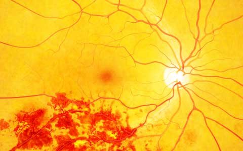 Memory problems, concentration problems and vision loss after vaccination and/or Covid-19